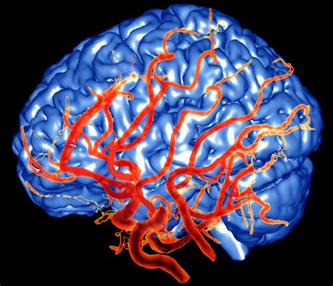 Propranolol for Migraines: How It Works, Dosage & .